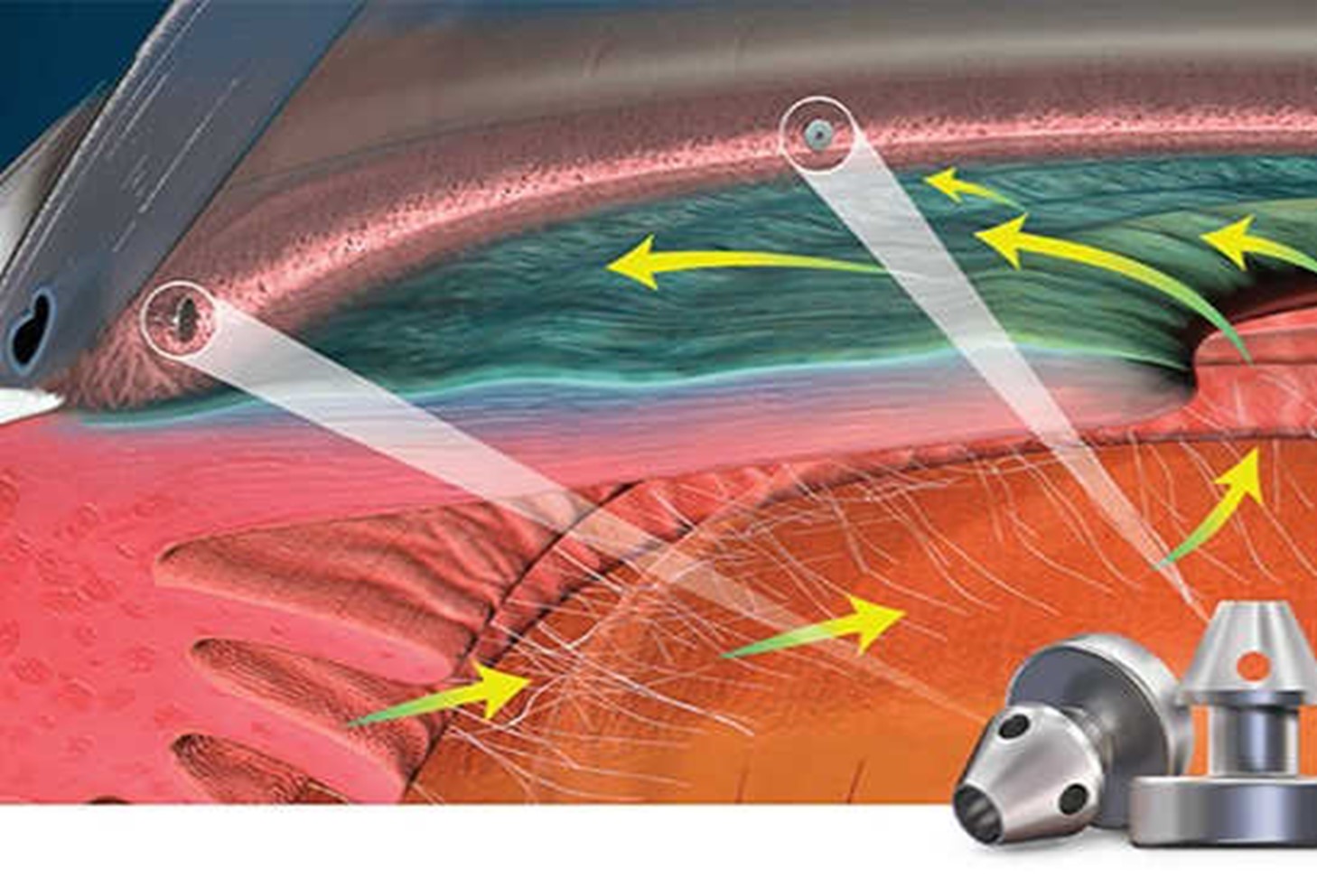 MIGS It's just business! NZ